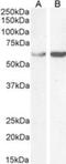 T-Complex 1 antibody, NB100-1400, Novus Biologicals, Western Blot image 
