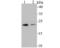 Proteasome Subunit Beta 8 antibody, NBP2-75554, Novus Biologicals, Western Blot image 