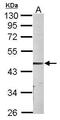 Parvin Alpha antibody, GTX118414, GeneTex, Western Blot image 