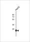 Dehydrogenase/reductase SDR family member 2 antibody, 61-889, ProSci, Western Blot image 