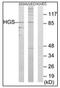 Hepatocyte Growth Factor-Regulated Tyrosine Kinase Substrate antibody, AP31347PU-N, Origene, Western Blot image 