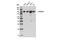 Actinin Alpha 1 antibody, 12413S, Cell Signaling Technology, Western Blot image 