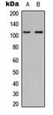 Myosin ID antibody, MBS8230075, MyBioSource, Western Blot image 