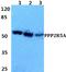 Serine/threonine-protein phosphatase 2A 56 kDa regulatory subunit alpha isoform antibody, A05935, Boster Biological Technology, Western Blot image 