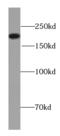 NEFH antibody, FNab05686, FineTest, Western Blot image 