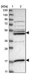 Inositol-Pentakisphosphate 2-Kinase antibody, PA5-54243, Invitrogen Antibodies, Western Blot image 