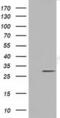 LRAT Domain Containing 2 antibody, MA5-25225, Invitrogen Antibodies, Western Blot image 