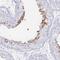 Leucine Rich Repeat Containing 37A antibody, HPA049080, Atlas Antibodies, Immunohistochemistry frozen image 