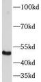 K12 antibody, FNab04650, FineTest, Western Blot image 
