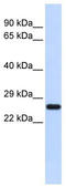 Superoxide Dismutase 2 antibody, TA344296, Origene, Western Blot image 