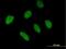 Zinc Finger And BTB Domain Containing 46 antibody, H00140685-B01P, Novus Biologicals, Immunofluorescence image 