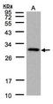 GRB2 Related Adaptor Protein antibody, orb73860, Biorbyt, Western Blot image 