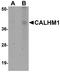 Calcium Homeostasis Modulator 1 antibody, A03599-1, Boster Biological Technology, Western Blot image 