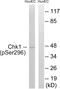 Checkpoint Kinase 1 antibody, AP55707PU-N, Origene, Western Blot image 