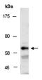 SHC Adaptor Protein 3 antibody, orb67257, Biorbyt, Western Blot image 