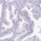 Ribosomal Protein L3 Like antibody, PA5-61891, Invitrogen Antibodies, Immunohistochemistry frozen image 