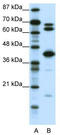 E2F2 antibody, TA329354, Origene, Western Blot image 
