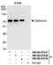 OPTN antibody, NB100-97837, Novus Biologicals, Immunoprecipitation image 