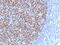 B-cell lymphoma 6 protein antibody, GTX34434, GeneTex, Immunohistochemistry paraffin image 
