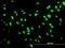 Autoantigen NOR-90 antibody, H00007343-M04, Novus Biologicals, Immunocytochemistry image 