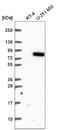 MTSS I-BAR Domain Containing 2 antibody, NBP2-57037, Novus Biologicals, Western Blot image 