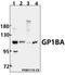 Glycoprotein Ib Platelet Subunit Alpha antibody, A02073-3, Boster Biological Technology, Western Blot image 