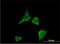 Calcium/Calmodulin Dependent Protein Kinase II Delta antibody, H00000817-M02, Novus Biologicals, Immunocytochemistry image 