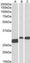 ANP32B antibody, MBS421267, MyBioSource, Western Blot image 
