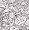 Nicotinamide Nucleotide Adenylyltransferase 1 antibody, FNab05767, FineTest, Immunohistochemistry paraffin image 