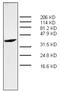 Protein S100-A7 antibody, AM32966PU-N, Origene, Western Blot image 