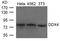 DEAD-Box Helicase 4 antibody, GTX50835, GeneTex, Western Blot image 