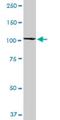 Rab GTPase-binding effector protein 1 antibody, H00009135-M06, Novus Biologicals, Western Blot image 