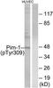 ETS2 Repressor Factor antibody, TA313846, Origene, Western Blot image 