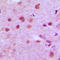 Nuclear Transcription Factor Y Subunit Gamma antibody, LS-C352586, Lifespan Biosciences, Immunohistochemistry frozen image 