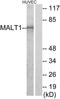 MALT1 Paracaspase antibody, LS-C199212, Lifespan Biosciences, Western Blot image 