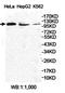 Centrosomal Protein 104 antibody, orb78236, Biorbyt, Western Blot image 