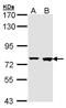Rabenosyn, RAB Effector antibody, NBP1-33649, Novus Biologicals, Western Blot image 