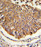 Malate dehydrogenase, mitochondrial antibody, A04803-1, Boster Biological Technology, Immunohistochemistry paraffin image 