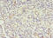 MTRR antibody, LS-C372257, Lifespan Biosciences, Immunohistochemistry paraffin image 