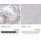 Zinc Finger Protein 821 antibody, NBP1-86290, Novus Biologicals, Immunohistochemistry paraffin image 