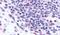 C-C Motif Chemokine Receptor 3 antibody, PA5-33396, Invitrogen Antibodies, Immunohistochemistry paraffin image 