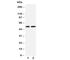 Myocyte Enhancer Factor 2C antibody, R30922, NSJ Bioreagents, Western Blot image 
