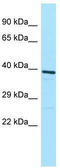 V-type proton ATPase subunit d 1 antibody, TA331311, Origene, Western Blot image 