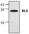 BLK Proto-Oncogene, Src Family Tyrosine Kinase antibody, GTX59617, GeneTex, Western Blot image 