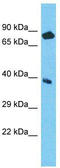 Probable aminopeptidase NPEPL1 antibody, TA337470, Origene, Western Blot image 