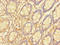 Small Glutamine Rich Tetratricopeptide Repeat Containing Beta antibody, orb356687, Biorbyt, Immunohistochemistry paraffin image 