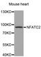 Nuclear Factor Of Activated T Cells 2 antibody, A3107, ABclonal Technology, Western Blot image 