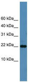 SREK1 Interacting Protein 1 antibody, TA331422, Origene, Western Blot image 