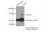 Signal Transducing Adaptor Molecule 2 antibody, 13009-1-AP, Proteintech Group, Immunoprecipitation image 