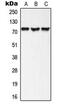 A-Kinase Anchoring Protein 10 antibody, GTX54934, GeneTex, Western Blot image 